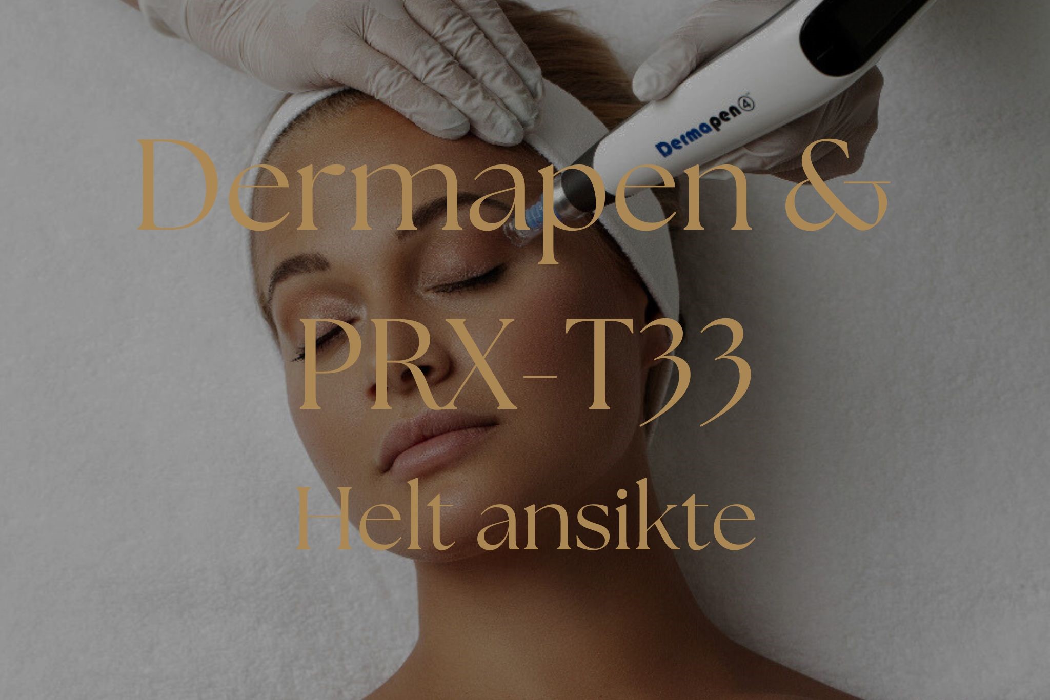 Dermapen + PRX-T33 - Helt ansikte