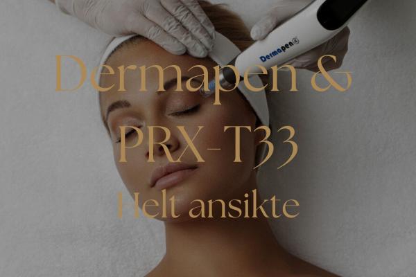 Dermapen + PRX-T33 - Helt ansikte