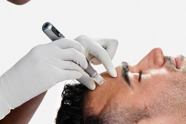 (Course of 4) PRO SKIN NEEDLING