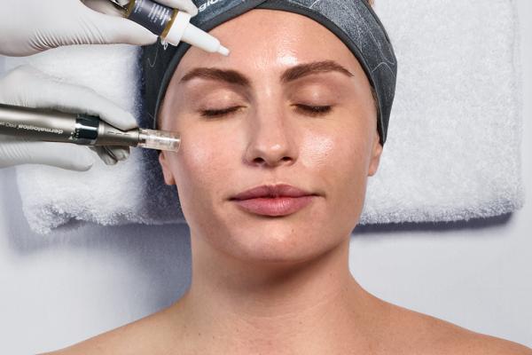 (Course of 3) EXO BOOSTER MICRONEEDLING