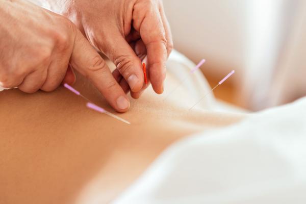 Accupuncture
