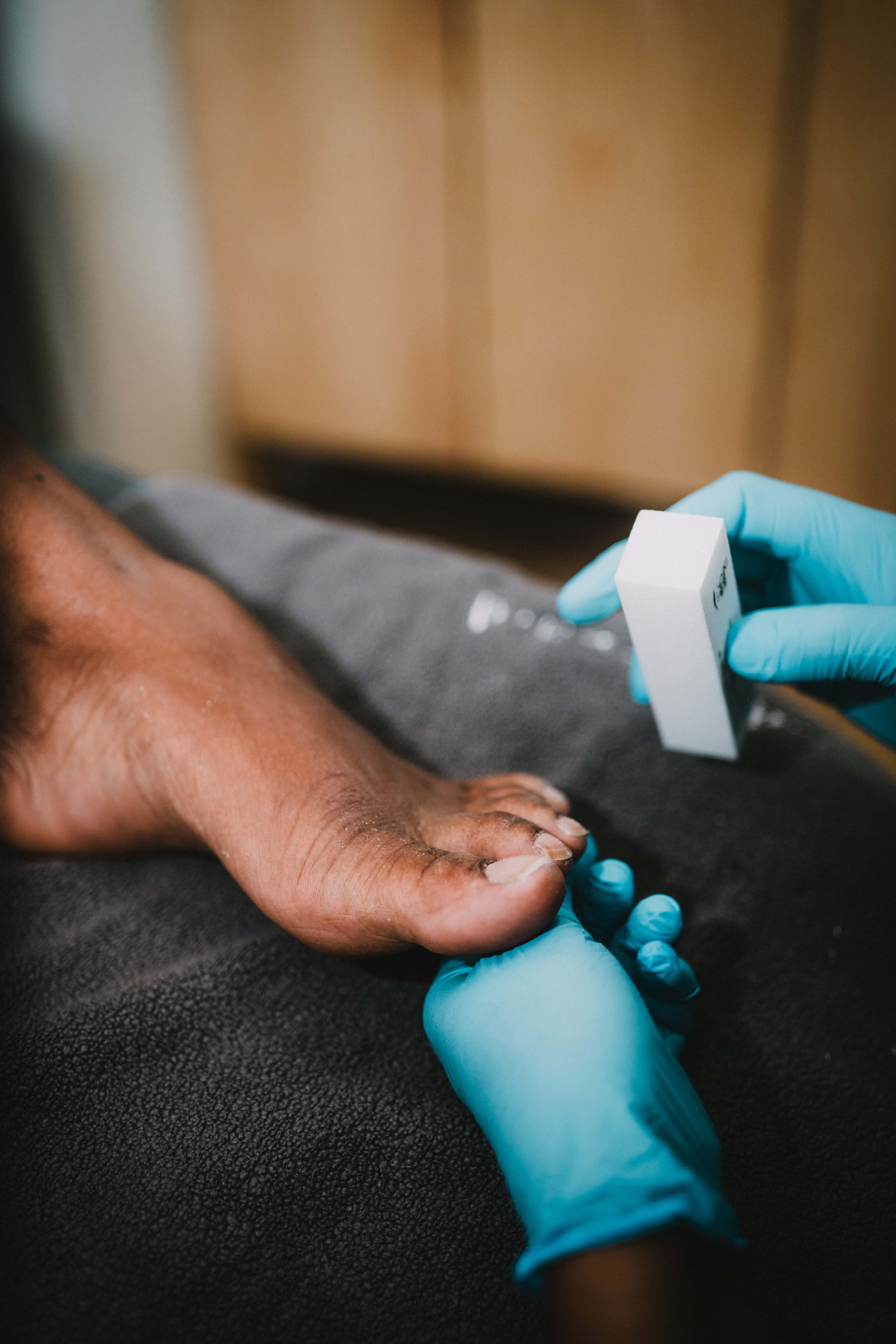 Dépose semi-permanent Pieds