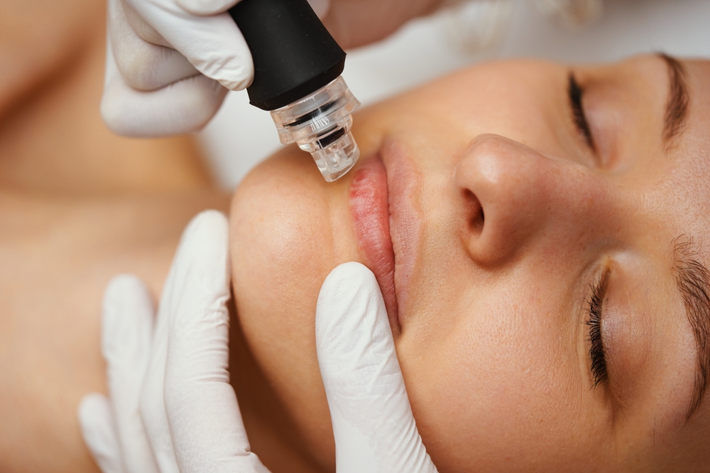 Microdermabrasion 25 min