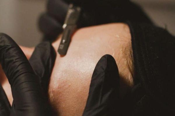 Dermaplaning Facial