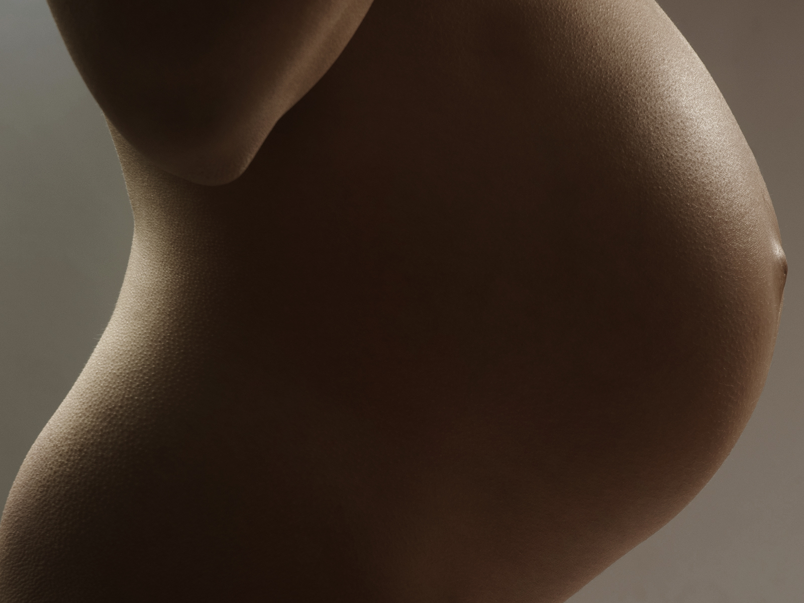 Dermapen Pregnancy Stretch Marks