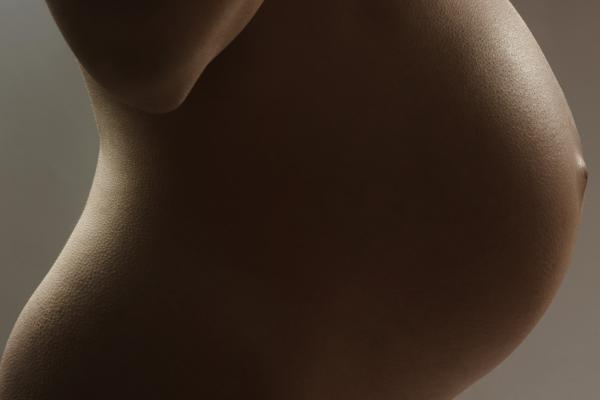Dermapen Pregnancy Stretch Marks