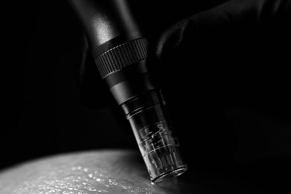 Microneeding with Exosomes (face only)