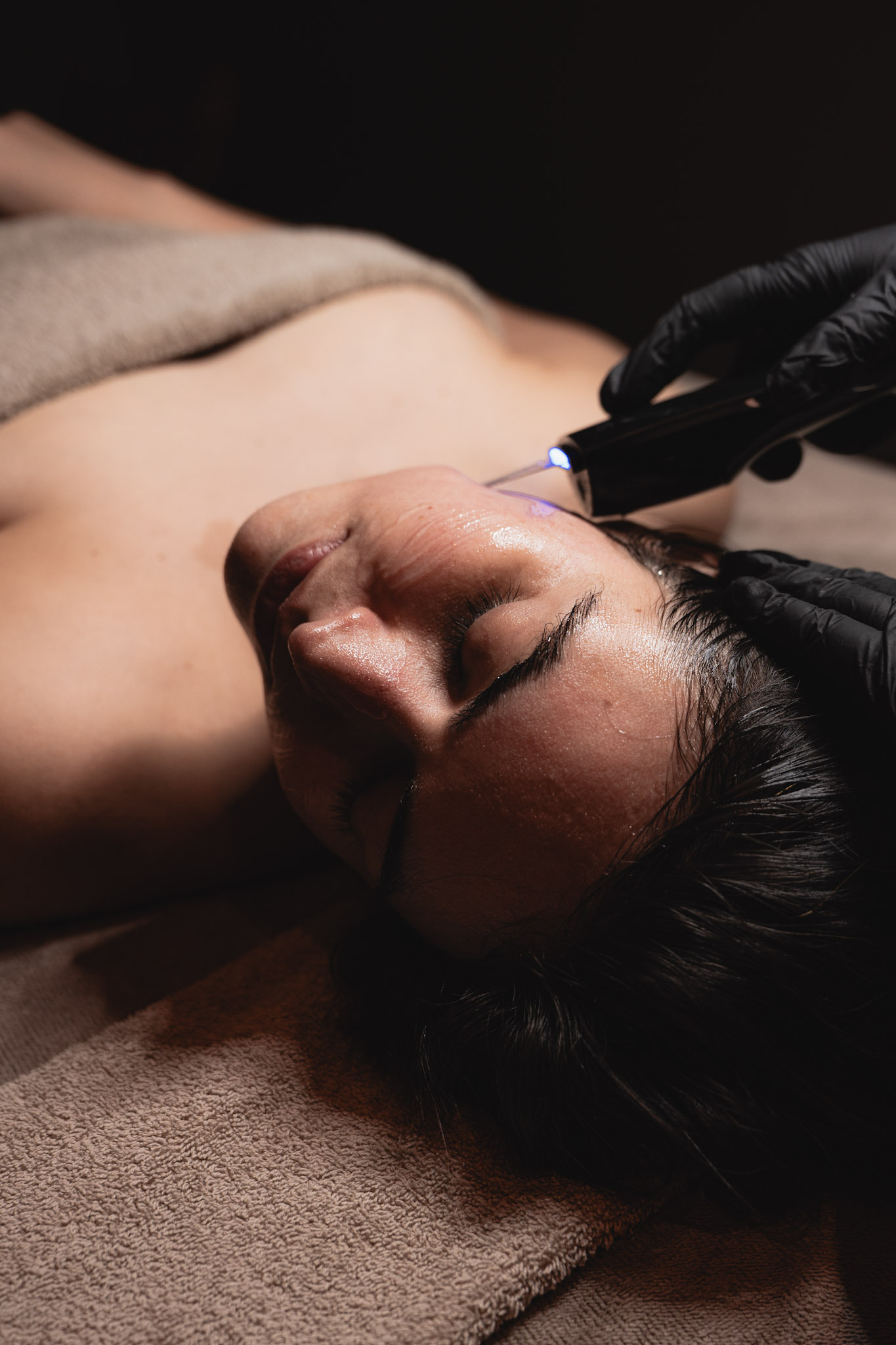 Dermapen Face, Neck & Décolletage