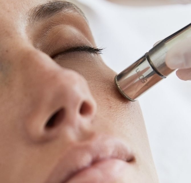 Enhancement - Microdermabrasion