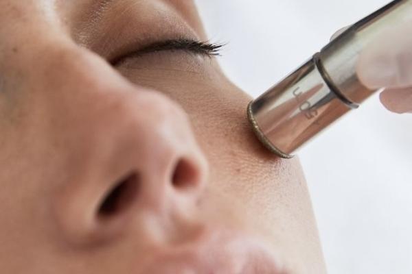 Enhancement - Microdermabrasion