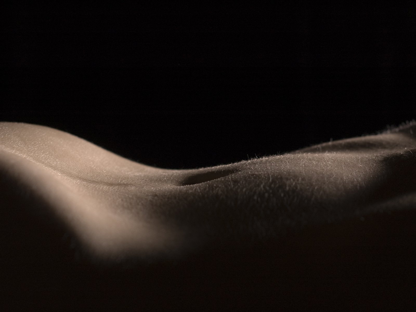 Dermapen Pregnancy Stretch Marks