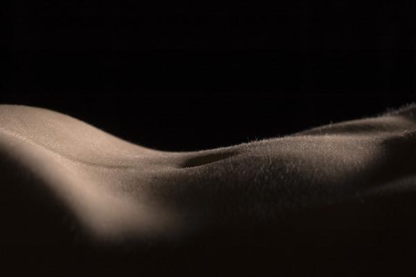 Dermapen Pregnancy Stretch Marks