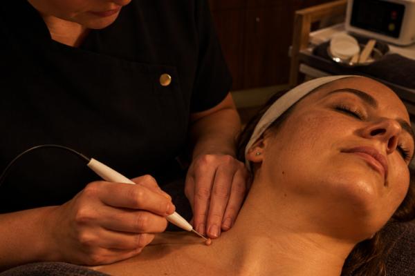 Skin Tag Removal and Consultation
