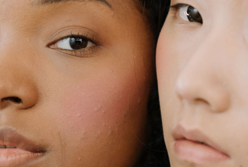 Teen Facial | 25 Mins
