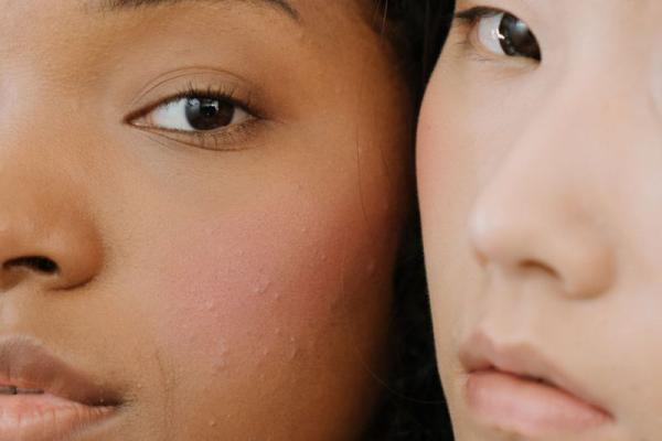 Teen Facial | 25 Mins