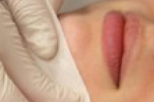Lip Or Chin Wax