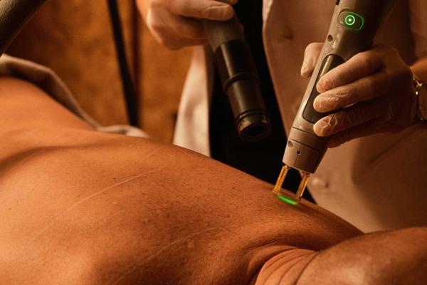 Hårfjerning med laser