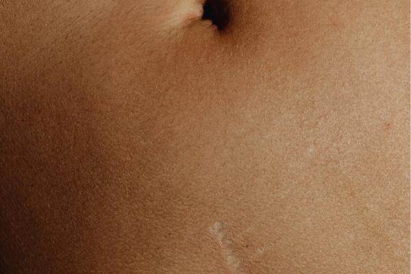 Body Bliss Lymphatic Drainage Massage - 60 Minutes